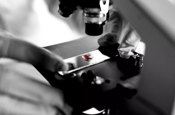 Understanding Tumor Markers in Pancreatic Cancer: Their Role and Implications