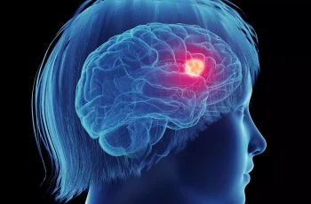 Investigating the Link Between Postmenopausal Hormone Therapy and Glioma Risk: A Critical Review