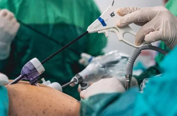 Bariatric Surgery: A Pathway to Improved Outcomes for Patients with MASH-Related Cirrhosis